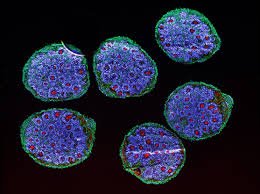 Organoid brain