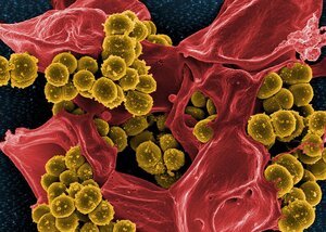 host pathogen
