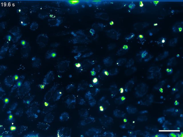 neutrophil rolling